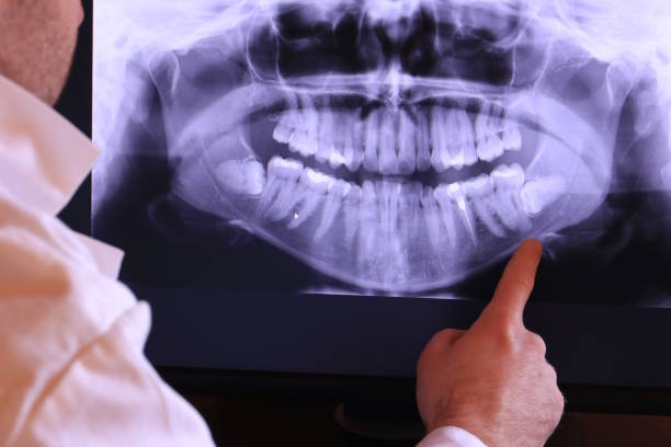 Best Emergency Treatment for Dental Infections or Abscesses in Dentsville, SC