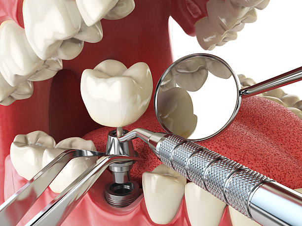 Best Cosmetic Emergency Dentistry in Dentsville, SC